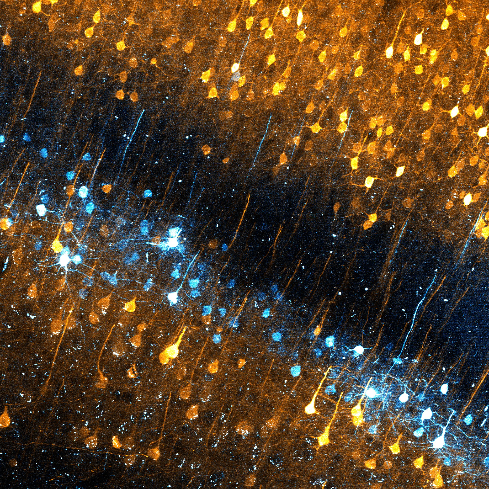 Z-stack projection of cortical neurons