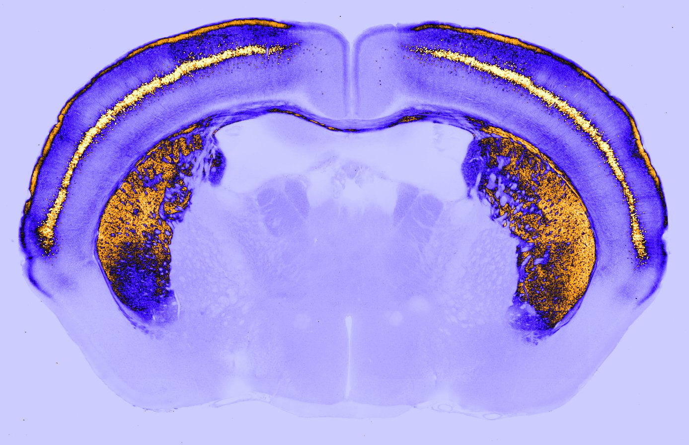 Fluorescence image of a Tlx-3 x Ai14 mouse brain section